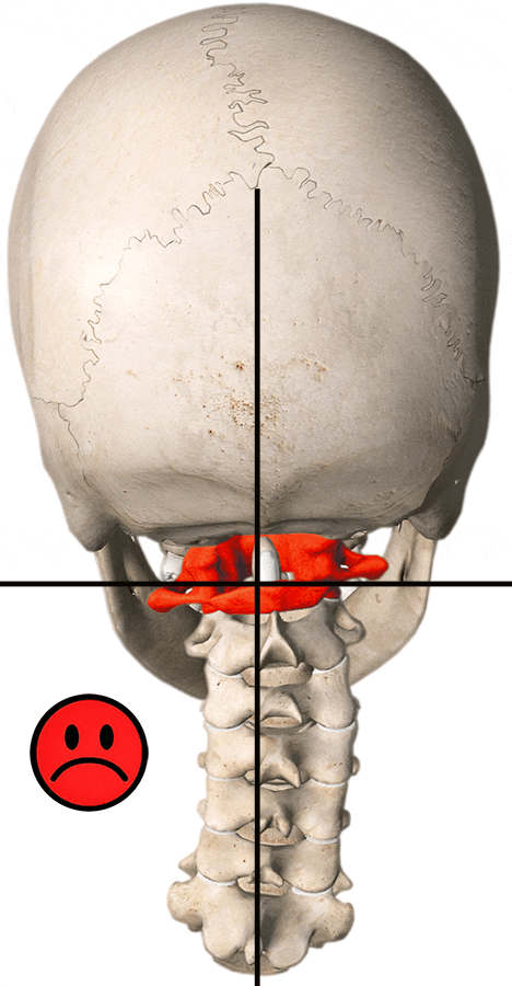Correction de l’Atlas