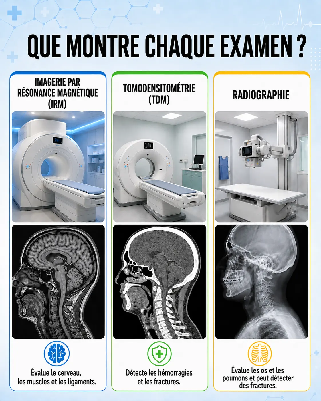 Appareil pour la tomographie en spirale CT