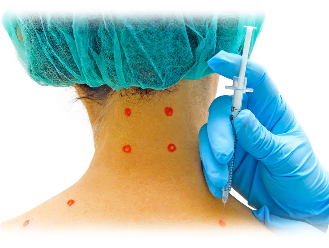 Injections contre la céphalée de tension