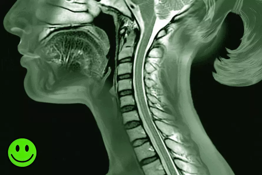Symptômes de rectitude du rachis cervical Symptômes de rectitude du rachis cervical